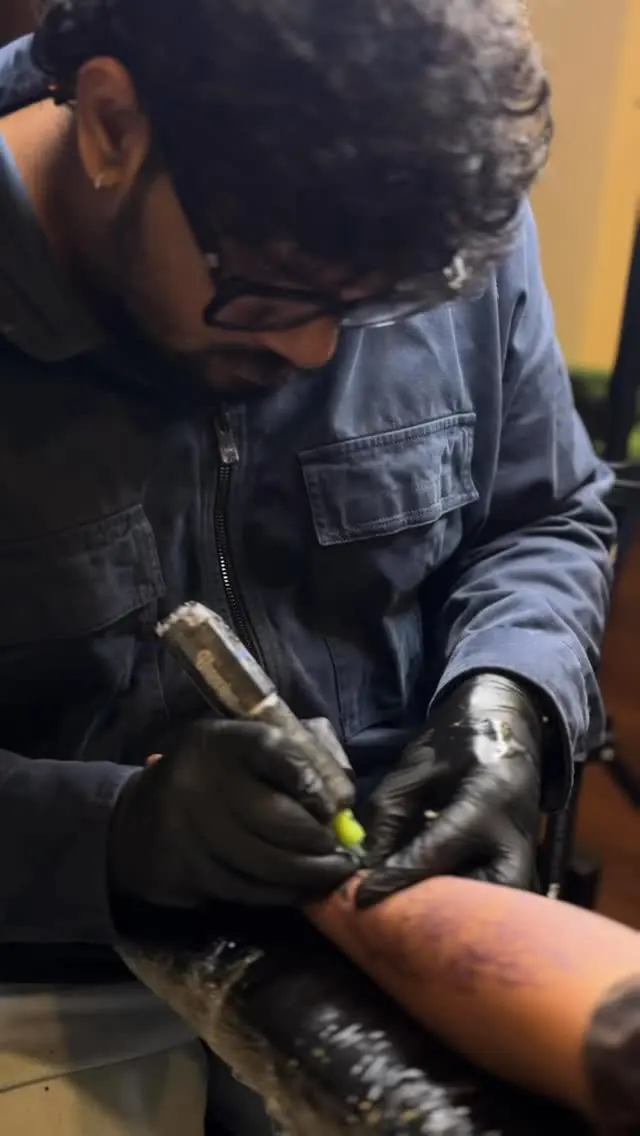 Close-up of Aswa's needle on skin